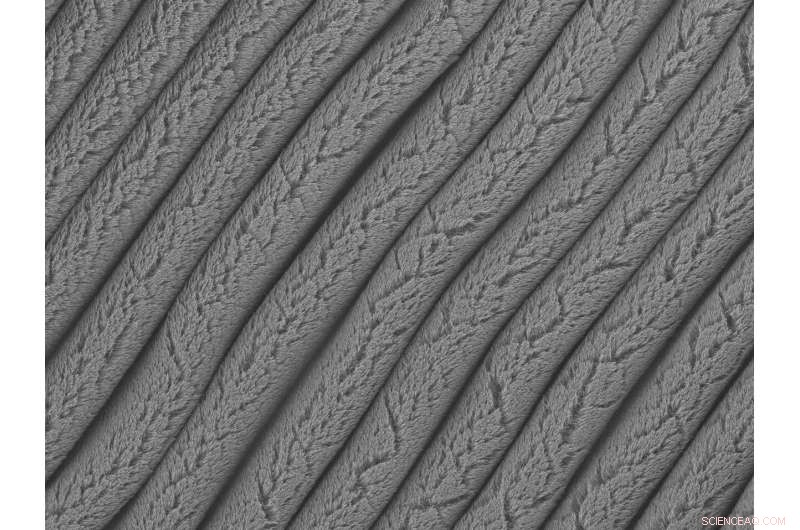 Stretchable Supercapacitors: Powering Tomorrow’s Wearable Devices