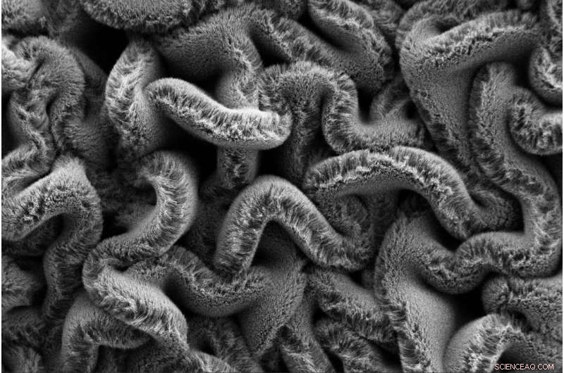 Stretchable Supercapacitors: Powering Tomorrow’s Wearable Devices