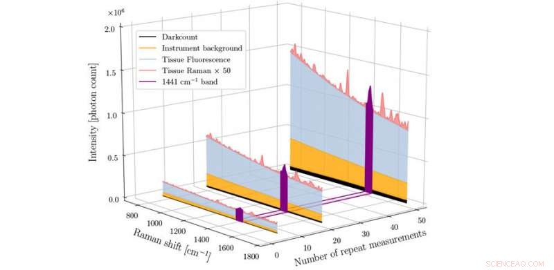 Rapid Clinical Adoption of Raman Spectroscopy Chemical Fingerprints
