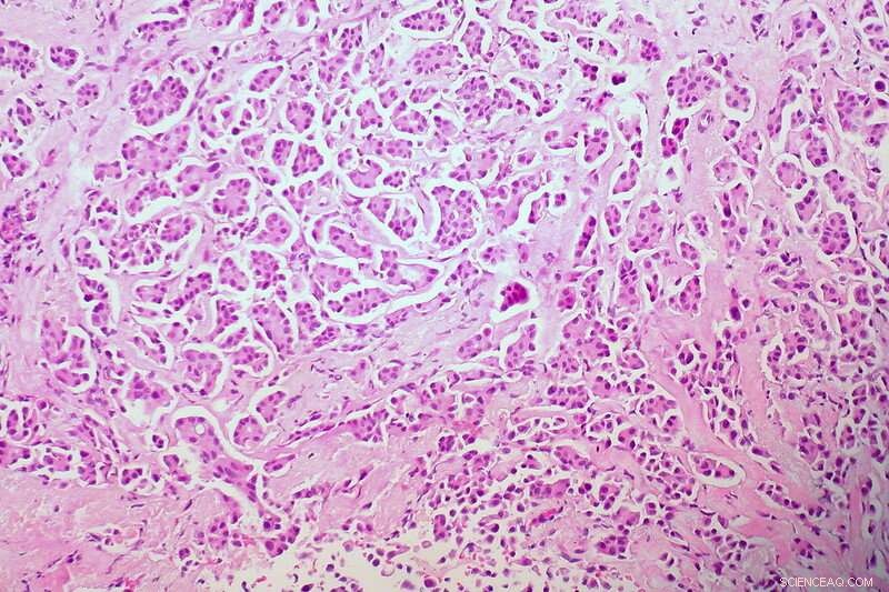 Chip‑Scale Microscopes: Expanding Expert Diagnostics to Remote Patients