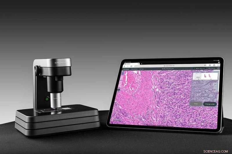 Chip‑Scale Microscopes: Expanding Expert Diagnostics to Remote Patients