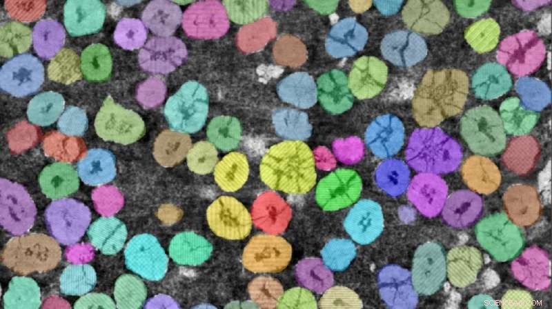 Computer Vision Accelerates Lithium‑Ion Battery Degradation Research