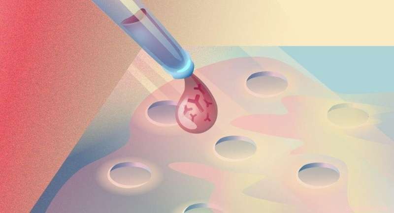 New Diagnostic Tool Promises Accurate Monitoring of Autoimmune Disorders