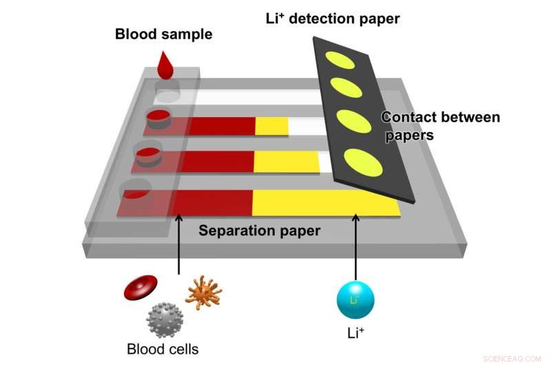 Rapid Paper-Based Device Detects Blood Lithium Levels in Bipolar Disorder Patients