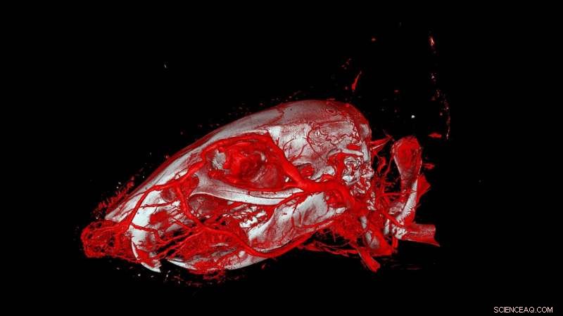 Enhanced Usability and Precision in Vascular Imaging with Advanced X-ray Contrast Agents