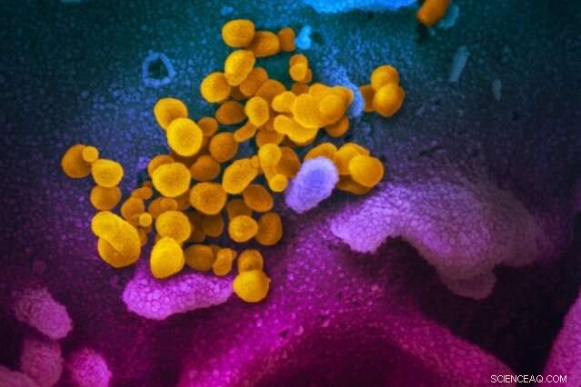 Uncertainty Surrounds Convalescent Plasma Benefits in COVID-19 Treatment