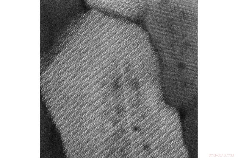 Northwestern University Study Uncovers Atomic-Scale Enamel Flaws That Trigger Tooth Decay