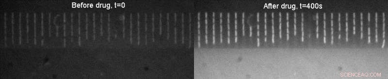 Glowing Drug Technique Promises Rapid Antibiotic Effectiveness Predictions