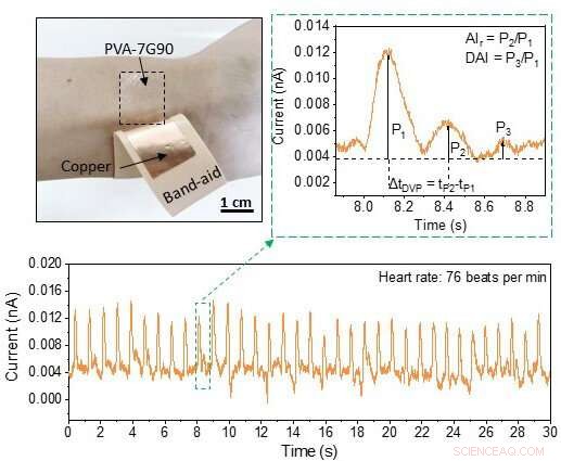 Purdue Innovation: Self-Powered Wearable Device for Real-Time Heart Health Monitoring