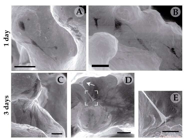 Revolutionizing Bone Implants: 3D Titanium Nanostructure Enhances Osseointegration
