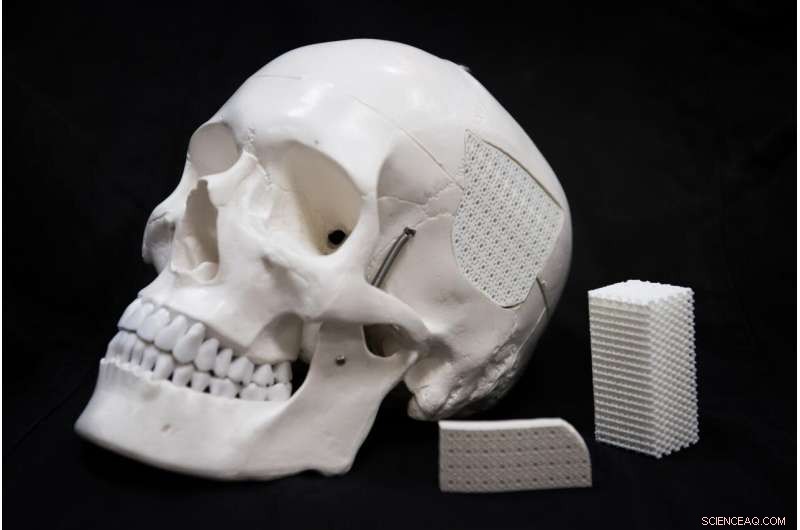Eggshell-Derived Bioactive Polymer‑Ceramic Composite for Skull Injury Repair