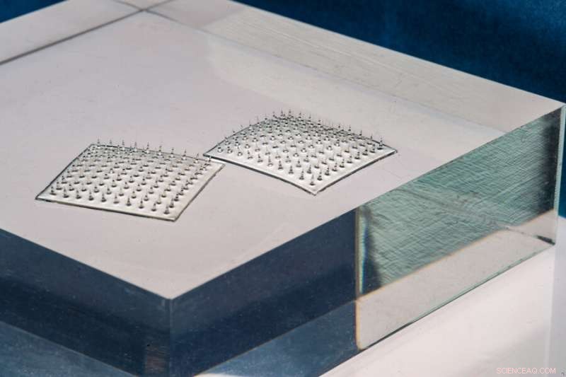 Velcro-Style Food Sensor Detects Spoilage and Contamination Early