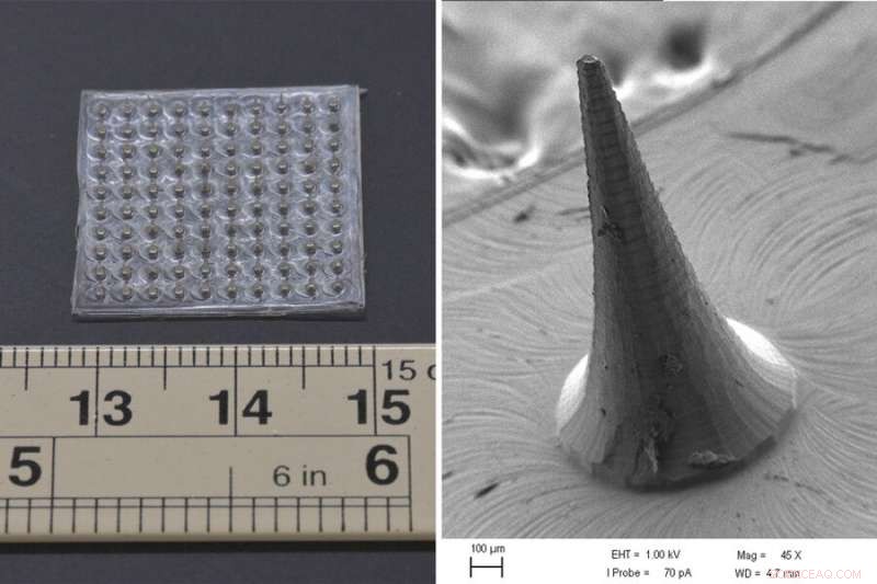 Velcro-Style Food Sensor Detects Spoilage and Contamination Early