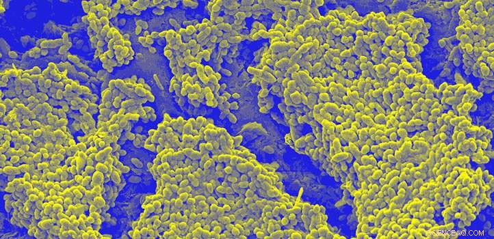 Innovative Bacterium Enhances Sludge Power, Delivering Faster and Higher Electricity Output