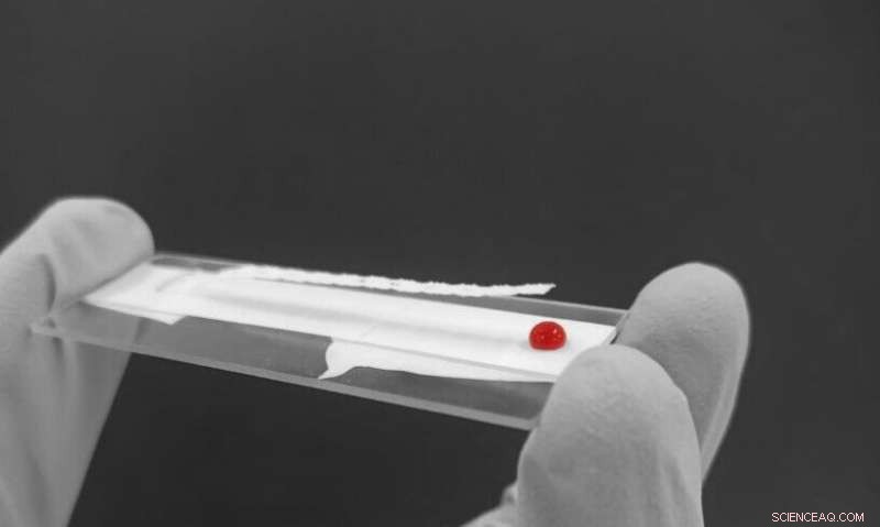 New Rapid Blood Loss Diagnostic Could Save Millions Worldwide