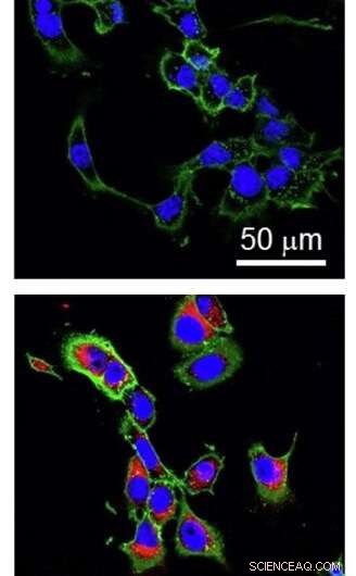 Shrimp Shell‑Derived Polymer Shows Promise as Targeted Anti‑Cancer Drug Delivery System