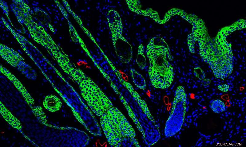 Innovative Biomaterials Enhance Skin Regeneration by Stimulating the Immune System