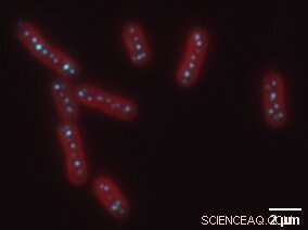Exploring Membrane Dynamics in Membraneless Organelles
