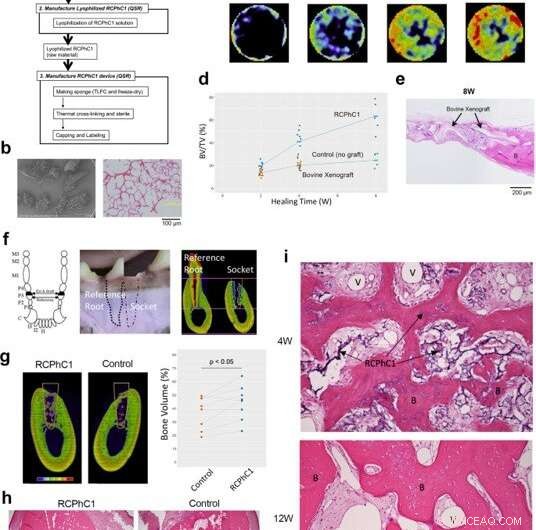 Recombinant Collagen Polypeptide: A Versatile Biomaterial for Bone Grafting