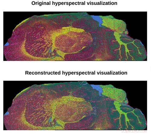 Accelerated High-Resolution Mass Spectrometry Imaging with Novel Computational Approach