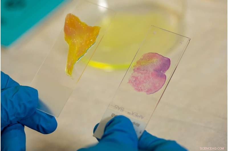 AI-Powered Microscope Quickly Determines Cancer Margins in Minutes