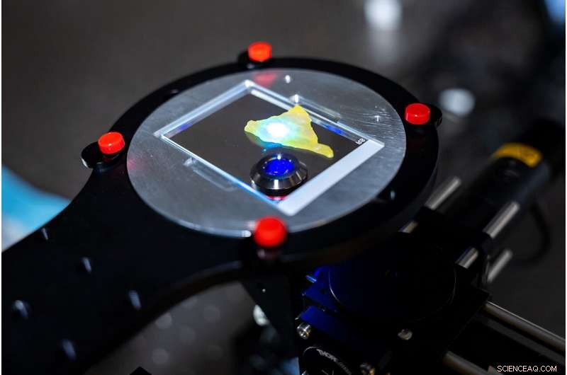 AI-Powered Microscope Quickly Determines Cancer Margins in Minutes