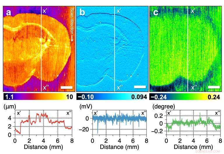 Diagnosing Brain Disorders with Mass Spectrometry Imaging: A Future Diagnostic Tool