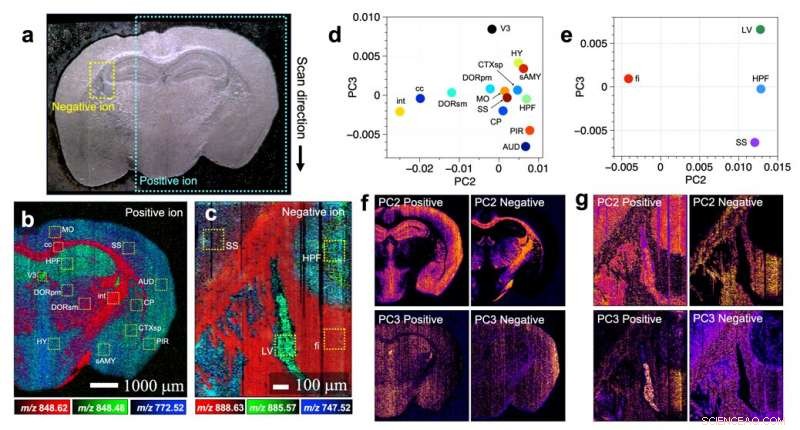 Diagnosing Brain Disorders with Mass Spectrometry Imaging: A Future Diagnostic Tool