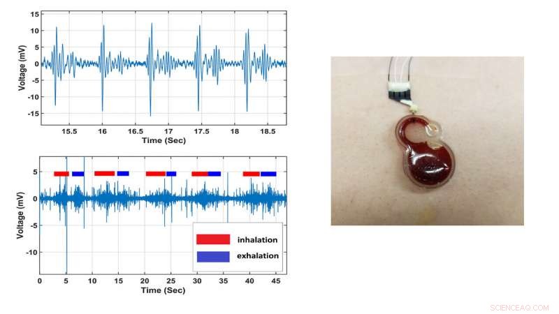Continuous Cardiac & Respiratory Monitoring with Wearable Electronics