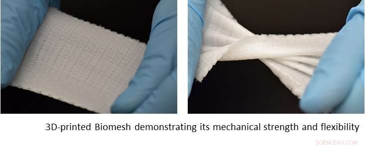 Innovative 3D‑Printed Biomesh Lowers Hernia Repair Complications