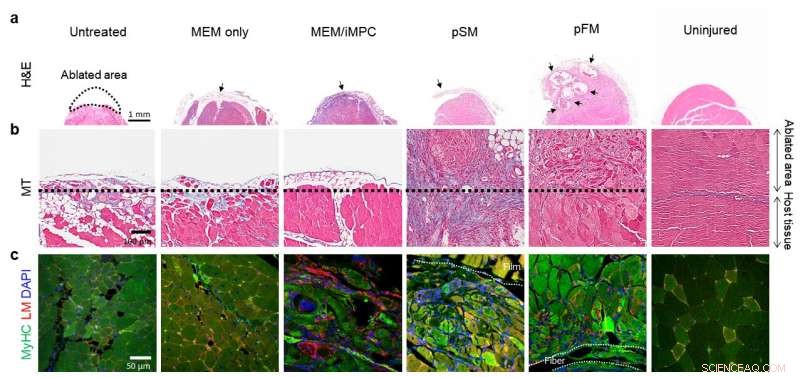 Hybrid Bioengineered Muscle Fibers: Engineered Solutions for Regenerative Medicine
