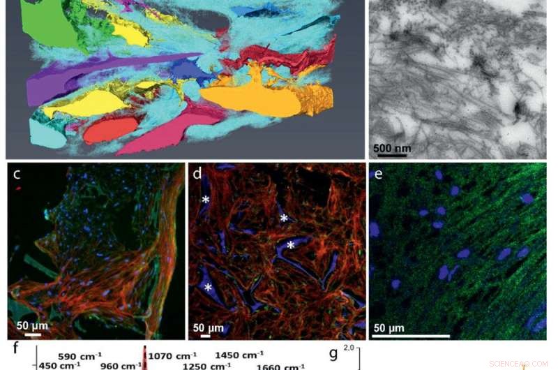 Scientists Grow Highly Realistic Bone Tissue from Woven Stem Cells