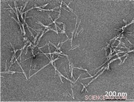 Understanding Amyloid Fibril Growth: Protein Fiber Formation and Disease