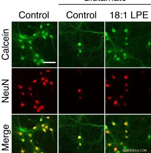 Oleoyl-LPE Enhances Neurite Outgrowth and Provides Neuroprotection