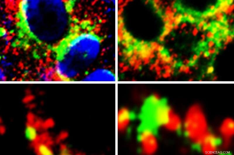 New COVID-19 Treatment Target Identified: Promising Pathway Uncovered