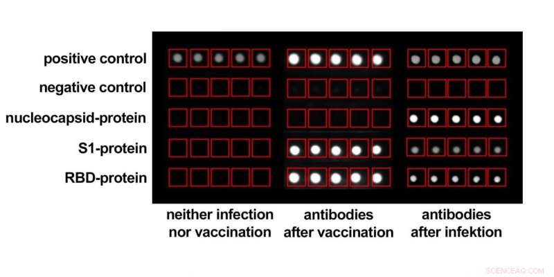Fast, Reliable, Versatile SARS-CoV-2 Antibody Test