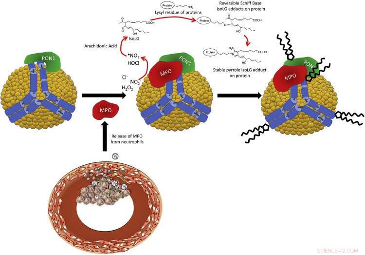 PON1-MPO-apoA-I Complex on HDL: A Promising Protective Mechanism Against Atherosclerosis