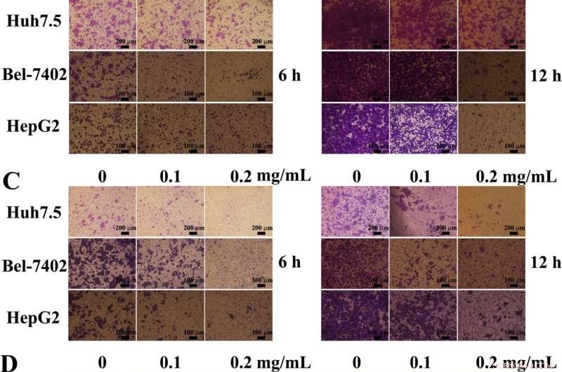 EPS11, a Marine Bacterial Exopolysaccharide, Blocks Migration and Invasion of Liver Cancer Cells