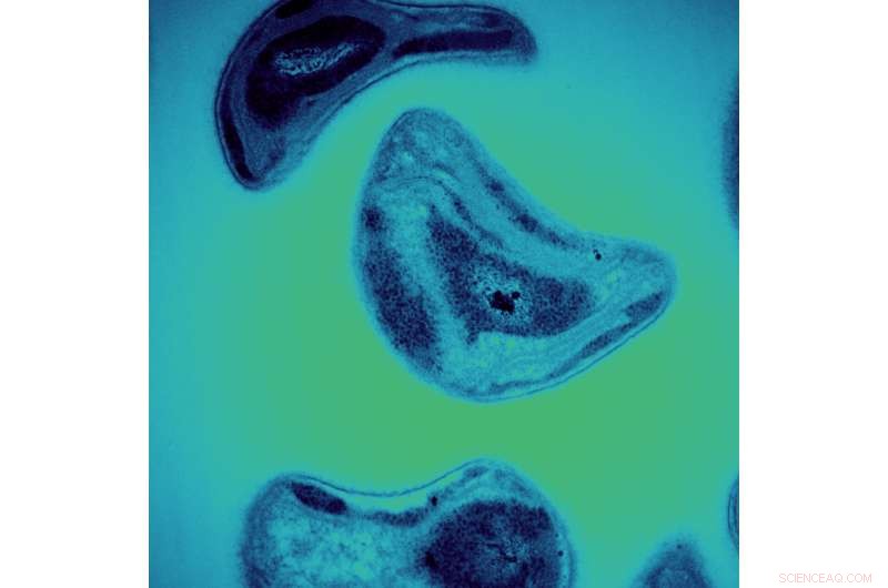 Microbes Turn Methane into Clean Energy While Degrading Toxic Methylmercury