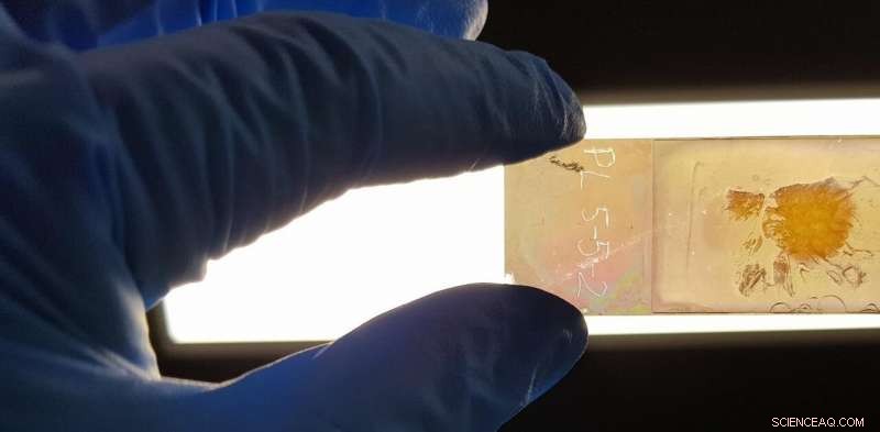 Revolutionary Color‑Revealing Microscope Slide Enhances Cancer Diagnosis