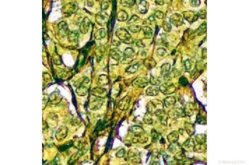 Revolutionary Color‑Revealing Microscope Slide Enhances Cancer Diagnosis
