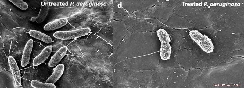Antibiotic-Free Gel Targets Drug-Resistant Bacteria, Boosting the Body’s Natural Immunity