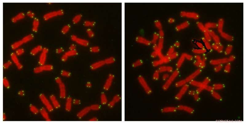 How CYREN Guides Precise DNA Repair and Prevents Cancer