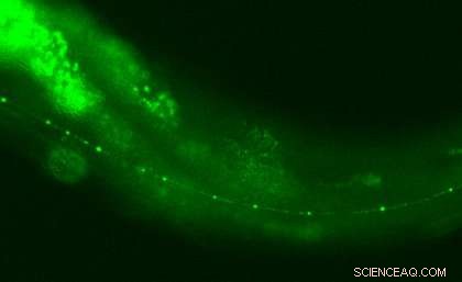 Groundbreaking Molecule Linked to Nerve Degeneration Revealed