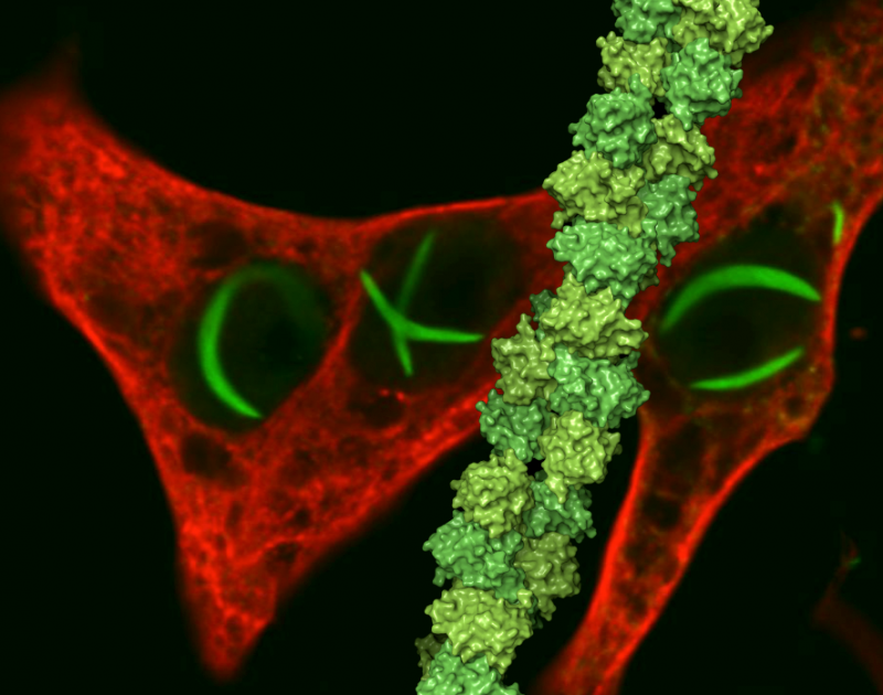 Unveiling the Architecture of Rift Valley Fever Virus Filaments: First Structural Insights