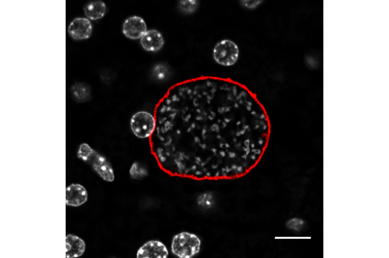 How Metabolism Shapes Your Risk of Malaria