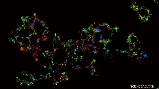 Scientists Uncover Molecular Pathways Enabling Cells to Escape Programmed Death