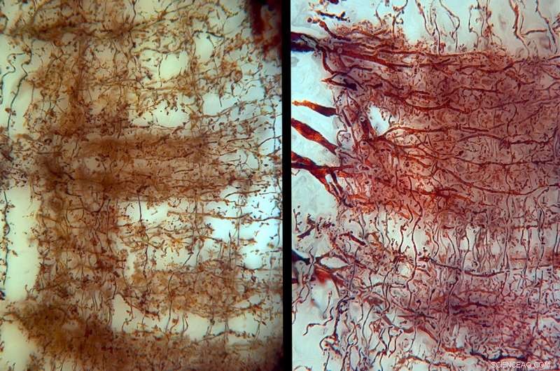 New Insights into Mantis Shrimp Brain Structures Reveal Advanced Visual Processing