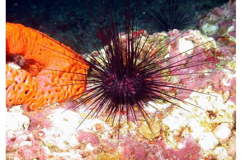 Scientists Identify Key Genes Distinguishing Human Complexity from Fruit Flies