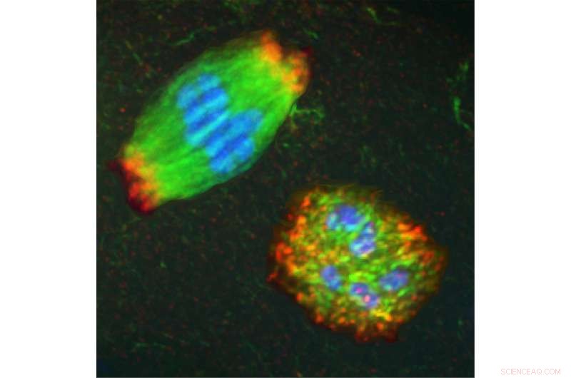 Groundbreaking Study Reveals Key Cause of Miscarriage and Birth Defects